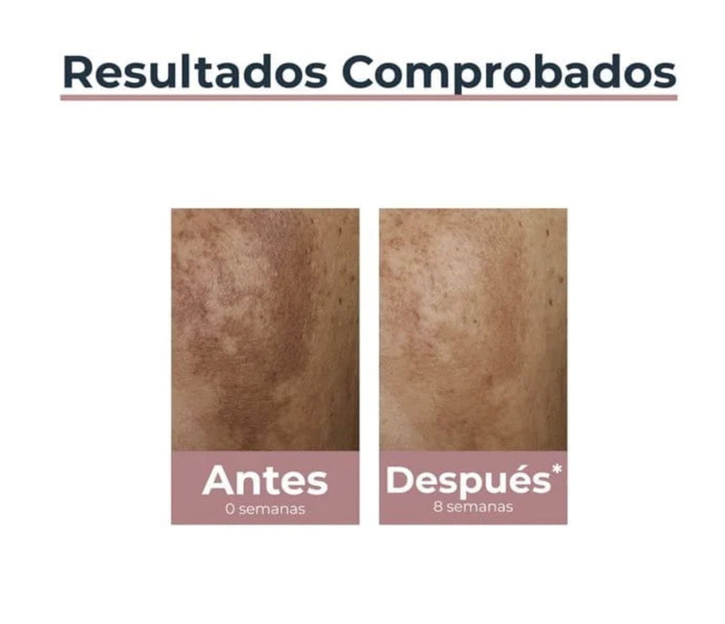 Anti-Pigment Crema de Noche