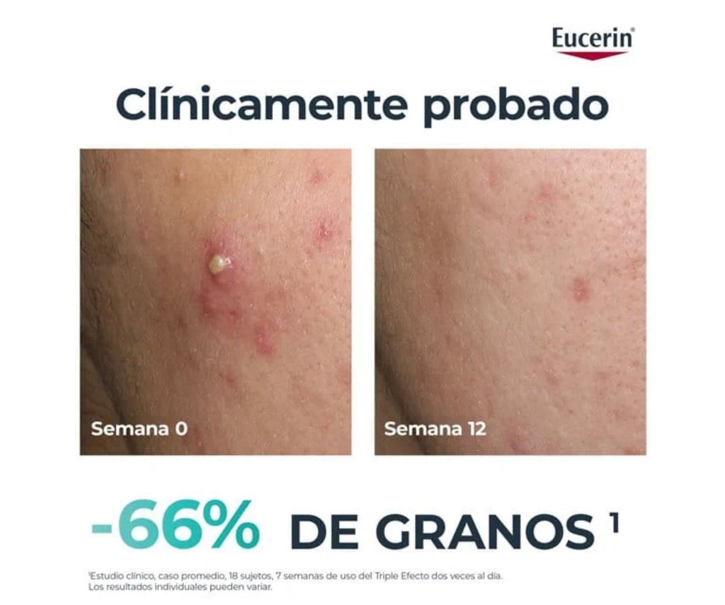 DERMOPURE CLINICAL
TRIPLE ACTION